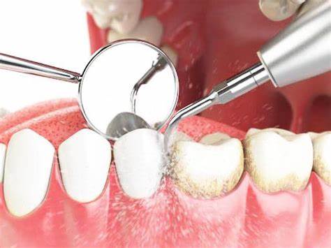 Tooth model - Royalty-free Human Teeth Stock Photo